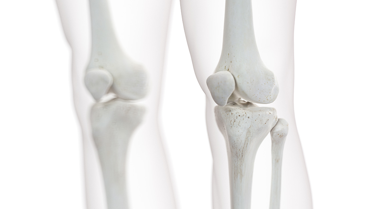 Image of Knee Joint