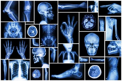 Collage of X-Rays
